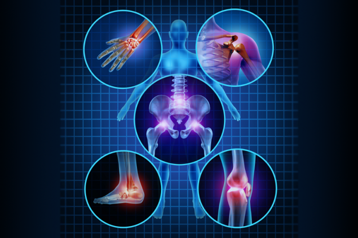 Pain and Inflammation